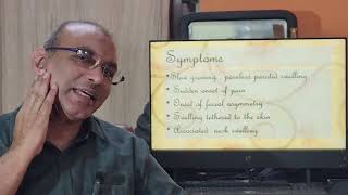 Mucoepidermoid tumor Parotid / Part 1 / Malayalam / Patient teaching programme