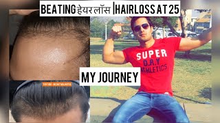 मेरा My Transformation| Beating hairfall| Minoxidil finasteride Results| Before and After| Hindi|