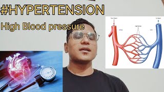 #Blood pressure#Hypertension#cause #management # home remedies #cause #Treatment