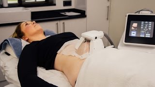 3D Lipo Treatment | Non-Surgical Liposuction | What is 3D Lipo?