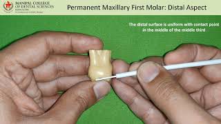 Distal aspect of permanent Maxillary First Molar