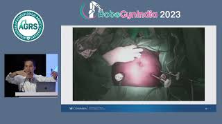 RoboGynIndia '23 Day 1 Master Class 1: ...Complex Benign Hysterectomy...