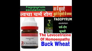 The Levocetrizine Of Homoeopathy/Fagopyrum Esculentum (Buck Wheat)//Treatment Of Skin Allergy .