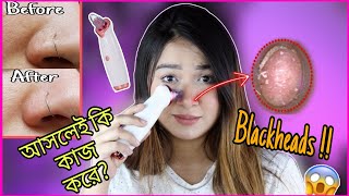 Blackheads Removal Device মাত্র ৭৫০ টাকায়!! || ব্ল্যাকহেডস্ দূর করে নিমিষেই ত্বকের পোরস কমাবে !! 😱😳