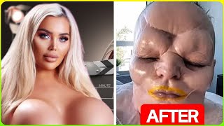 15 CELEBRITY PLASTIC Surgery Disasters That Leave You Speechless - Documentary