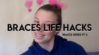 BRACES LIFE HACKS / #BRACES101