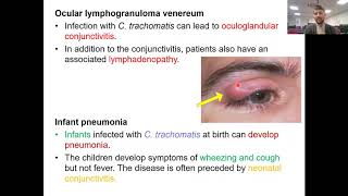 How Chlamydia causes Clinical Complications || Part 02