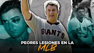 Las peores lesiones de la MLB 🥵 (Terribles lesiones que acabaron carreras)