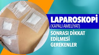 Laparoskopi Sonrası : Hamilelik | Cinsellik | Dikişler | Karın Şişliği | Dikkat Edilmesi Gerekenler