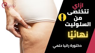 السلوليت؟! ايه أسبابه وازاي نتخلصي منه نهائيًا مع الدكتورة رانيا حلمي