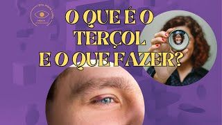 Tudo sobre Terçol - Dicas