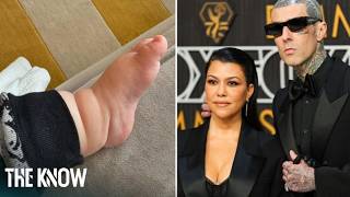 Kourtney Kardashian’s $999 Foot Recovery Secret! • The Know Official