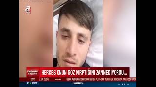 Prof Dr Ersin Erdoğan Hemifasiyal Spazm Cerrahi Tedavisi