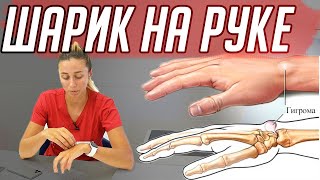 На руке вена как шарик. Исчезает как поднимешь. Что делать?