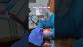 WDC - ENDO TREATMENT 2 I PSA I PERAWATAN SALURAN AKAR #dentist #shorts #short #shortvideo