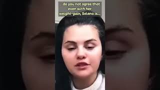 You're ugly (& FAT) now! - Selena Gomez  #selenagomez #shortswithcamilla #vaserlipo #buccalfat