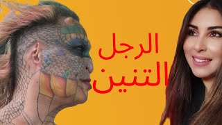 مأساة  رجل مريض بالايدز تحول الى تنين 😈