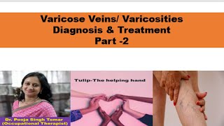 Varicose Veins part 2