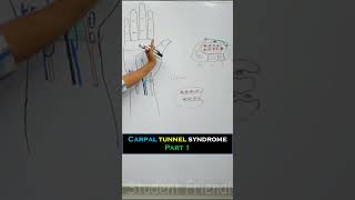 Carpal tunnel syndrome Part 1 -Full video in description  #anatomymadeeasy #anatomy #medical #mbbs