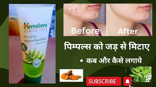 Himalaya Neem Face Wash | हिमालया नीम फेस वॉश| Uses And Benefits