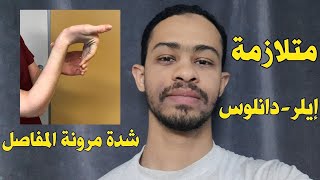 متلازمة ايرلز دانلوس|مرونة المفاصل الزائدة (اسباب، اعراض، تشخيص، علاج)