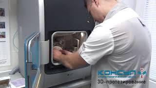 Этапы протезирования с помощью системы CadCam