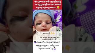 കുഞ്ഞിന് കണ്മഷി എഴുതാറുണ്ടോ 😱 അറിയുക 💯 #trending #malayalam #subscribe #short #live