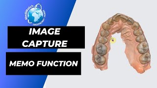 How to use the image capture and memo function in Medit Link