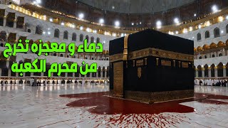 حقيقة وجود دم كثير في الحرم المكي بجوار الكعبة المشرفة