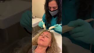 Microcurrent Facial – Forehead