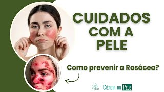 Cuidados com a Pele: Como Prevenir a Rosácea