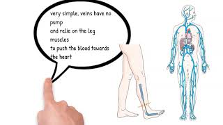 Varicose Vein II Capital vein links Clinic Edmonton