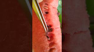 watermelon operation #nature #shorts