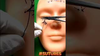 How to stitches , Different incisions with different techniques #stitching #suturing #fyp #viral