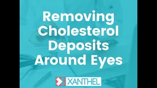 Removing Cholesterol Deposits Around  Eyes - LETS GET THEM REMOVED !