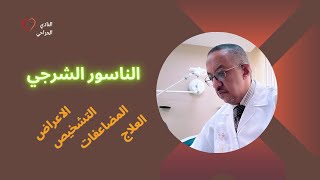 "الناسور الشرجي: كل ما تحتاج لمعرفته حول الأعراض، وطرق التشخيص، والمضاعفات، وأفضل خيارات العلاج"