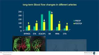 Bypass surgery for Moyamoya | MASSIN Congress Day 1 | Session 2, Talk 6