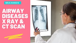 Airways Diseases  Radiology how to interpret by using X ray and CT scan