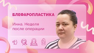 Инна. Однокурсница Е. С. Блефаропластика. 7 сутки после операции