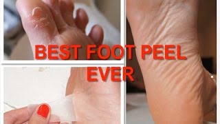 REVIEW: Foot Peel / Baby Foot - Pedicure Socks