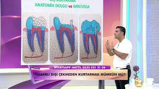 Etkin çiğneme ne demek? Anatomik Dolgular, Kaplamalar ve Dişler en etkin çiğnemeyi nasıl sağlar?