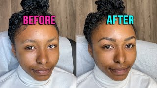 Microblading Literally Changed Her Life - Episode 53