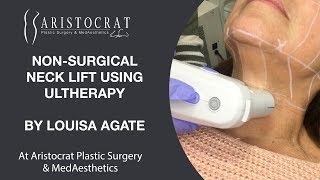 Non-Surgical Neck Lift: Ultherapy