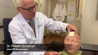 Trigeminal Neuralgia | Lenox Hill Neurosurgery