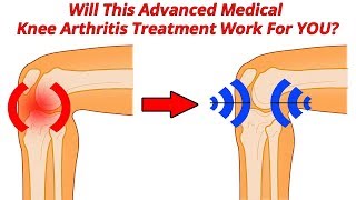 NYC Pain MD Knee Arthritis Treatment Genicular Nerve Block