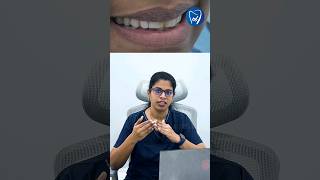 Damage ஆன tooth அ dental crowns மூலமா எப்படி சரி பண்ணலாம்?#thanjaidentalcentre