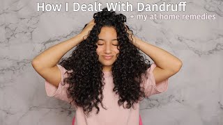 How I Dealt with Dandruff with my Curly Hair | Ny At Home Remedies