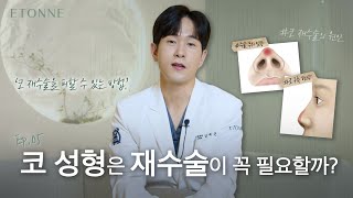 코성형 후 재수술은 무조건 해야할까? I 재수술을 피할 수 있는 방법