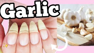 Nail Care at home with garlic|Long nails home remedy & exercise for shiny strong and beautiful Nails