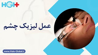 عمل لیزیک: همه‌چیز درباره جراحی لیزیک و چرا ایران مقصدی ایده‌آل برای آن است